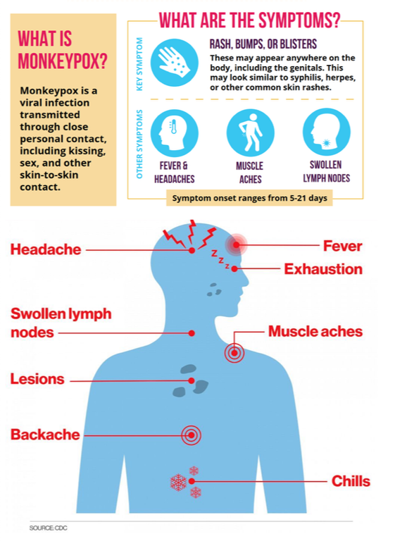 Monkeypox Signs & Symptoms (CDC, khalidCares)